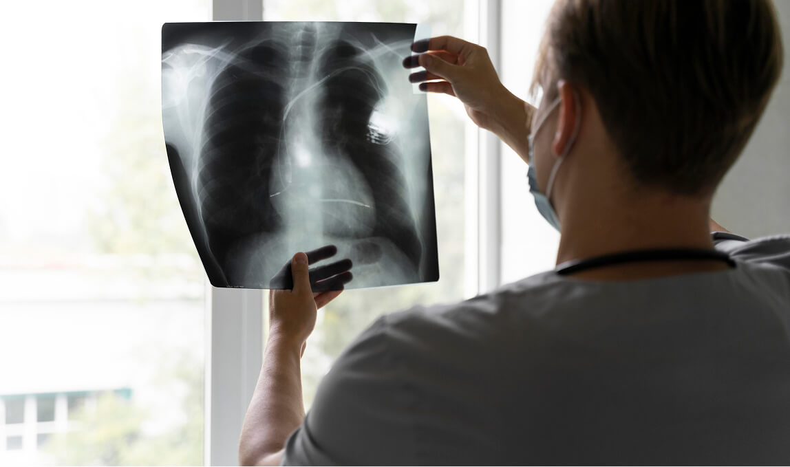 Medical specialist analyzing a chest X-ray to evaluate EGFR mutated lung cancer findings in a clinical setting