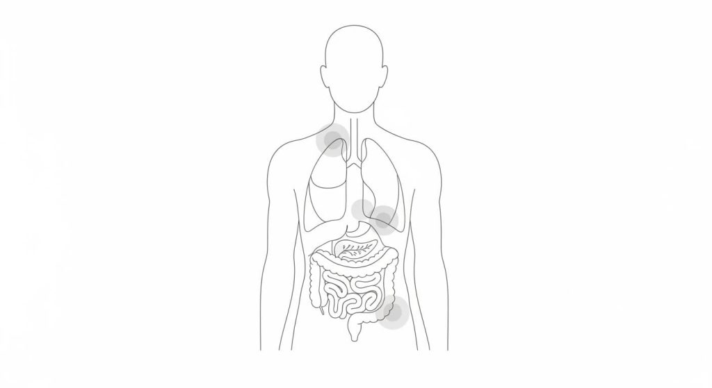 Neuroendocrine Tumors shown in a minimal clinical line-art illustration highlighting common body locations