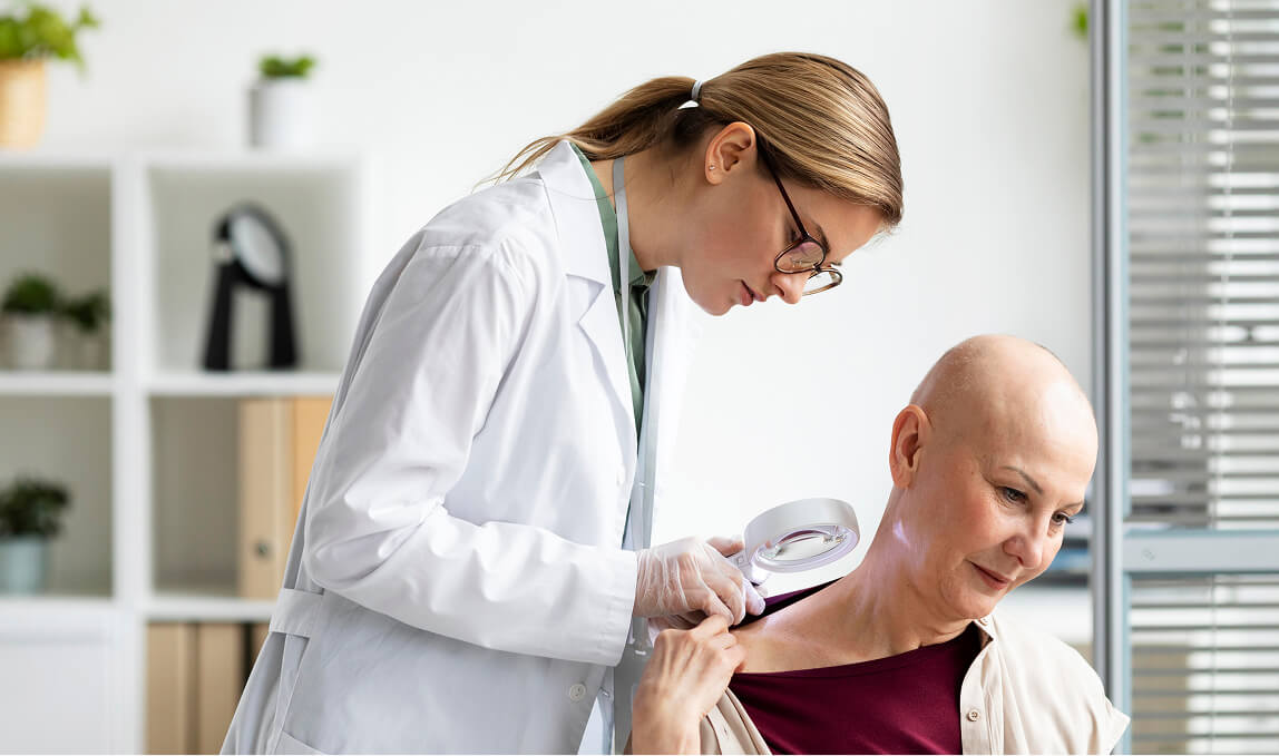 Dermatologist using a magnifying glass to examine a skin lesion on a cancer patient with alopecia during a clinical consultation