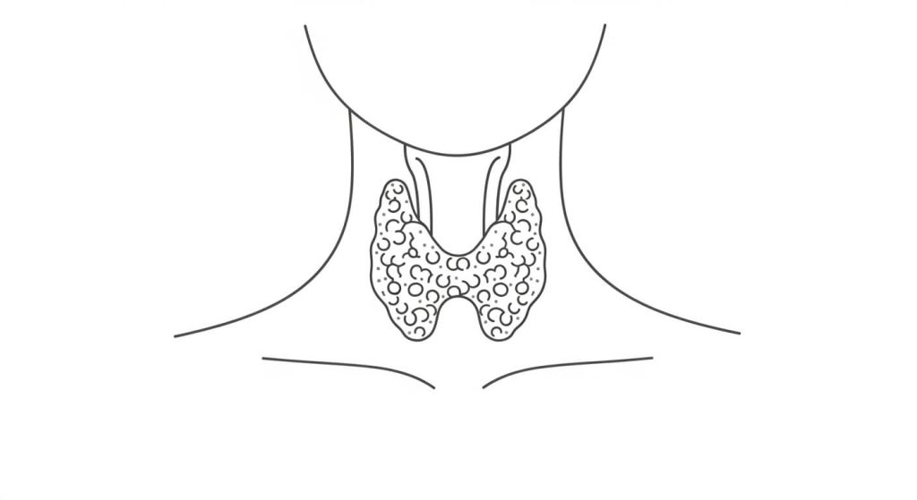 Thyroid cancer illustration showing the thyroid gland location at the base of the neck